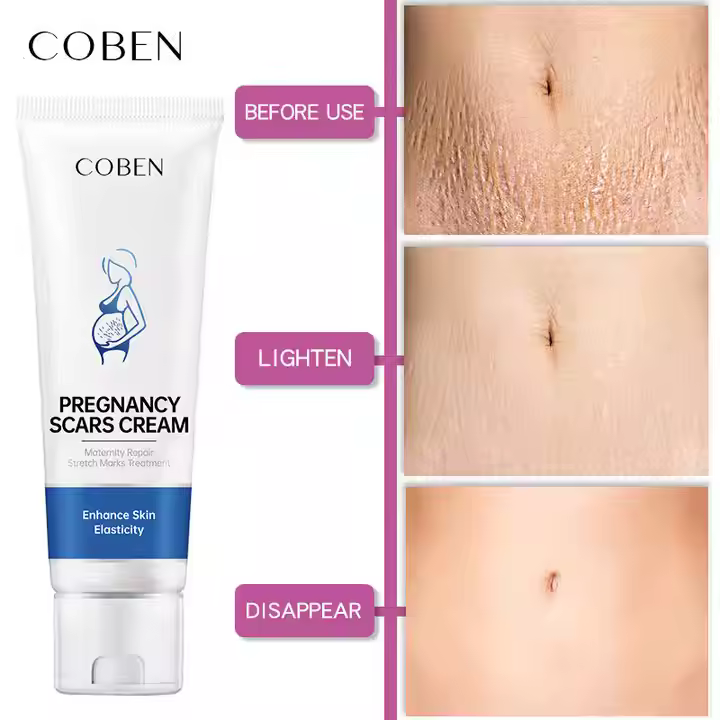Крем от растяжек Coben Pregnancy Scars Cream