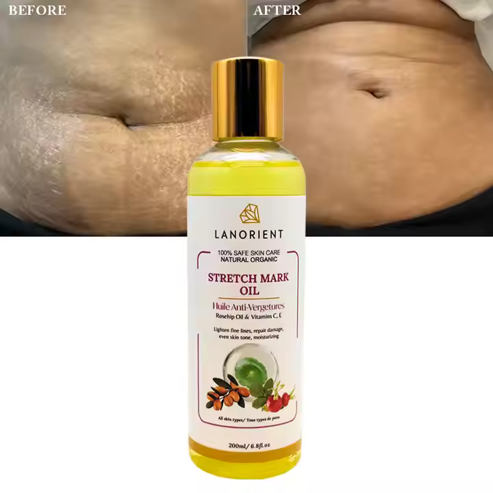 Лосьйон от растяжек Lanorient Stretch Mark Oil