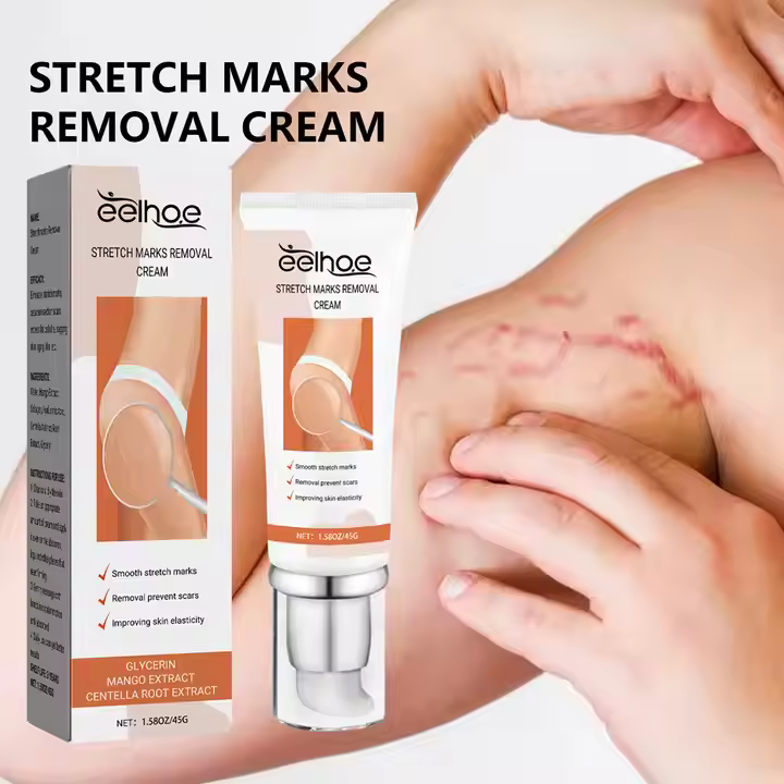 Лосьйон от растяжек TRETCH MARKS REMOVAL CREA