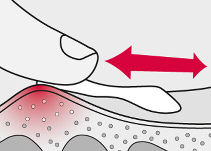 Protefix применение