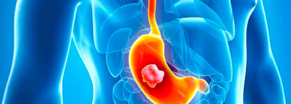 Голодание при гастрите - правильный подход к лечению